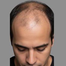 Before - ¡Un producto excelente!